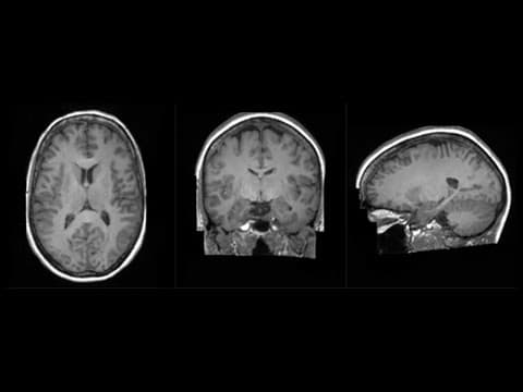 Synthetic Brain Project | King’s College London on NVIDIA Cambridge-1 thumbnail