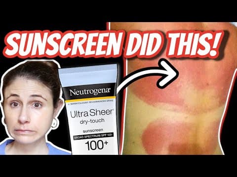 SUNSCREEN allergic reactions and rashes| Dr Dray thumbnail