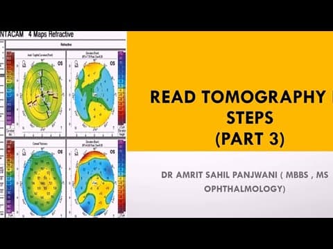 How to read corneal tomography printout || Pentacam thumbnail