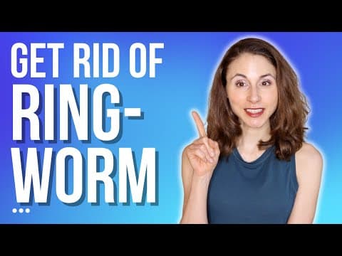 HOW TO GET RID OF RINGWORM 🤔 TIPS FROM A DERMATOLOGIST @DrDrayzday thumbnail