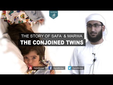 The Story of Safa & Marwa the Conjoined Twins  - Asim Khan thumbnail