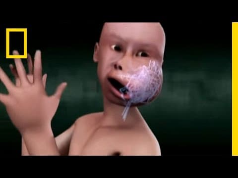Son's Swollen Veins  | National Geographic thumbnail