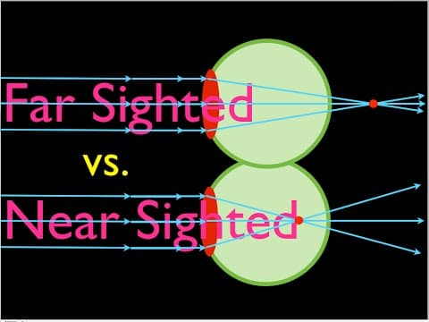 Farsighteness vs. Nearsightedness, An Explanation thumbnail