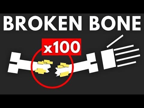 How Many Times Can You Break The Same Bone? thumbnail