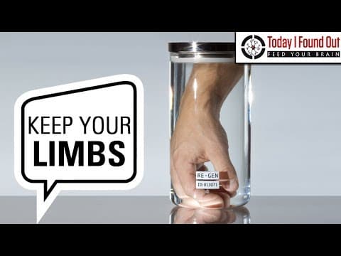 Can You Get Your Amputated Limb Back from the Hospital? thumbnail