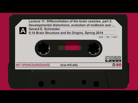 11. Differentiation of the brain vesicles, part 2: Developmental distortions; evolution of... thumbnail