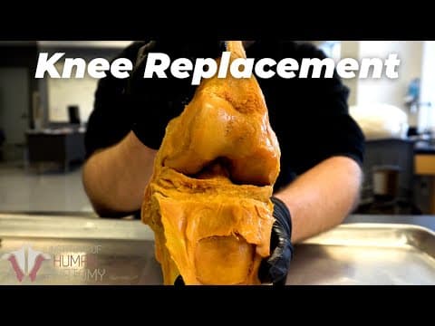 The Most Painful Surgery Ever? thumbnail