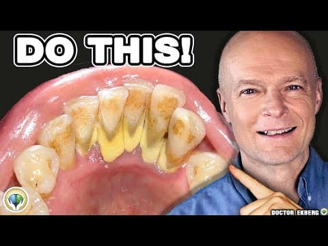 How to Prevent Tartar Buildup Naturally thumbnail