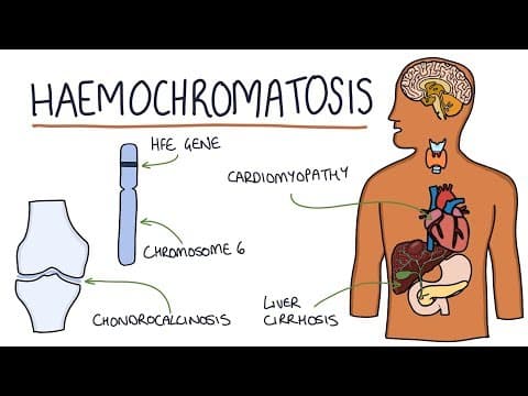 Understanding Haemochromatosis thumbnail