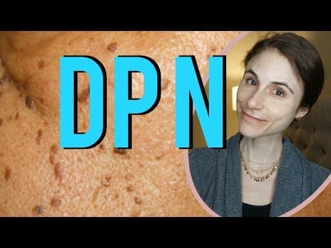 Dermatosis papulosa nigra (DPN) removal: Q&A with dermatologist Dr Dray thumbnail