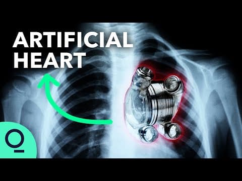 Permanent Artificial Hearts Are Closer Than You Think thumbnail