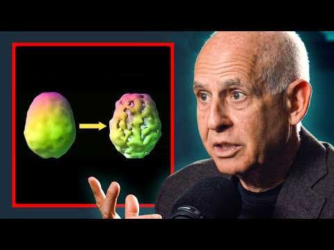 The Real Long-Term Effects Of Marijuana & Alcohol - Dr Daniel Amen thumbnail