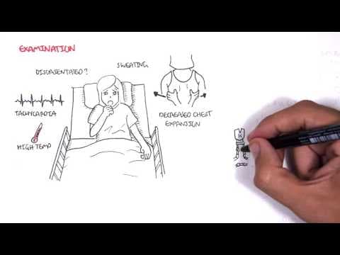 Community Acquired Pneumonia (DETAILED) Overview thumbnail
