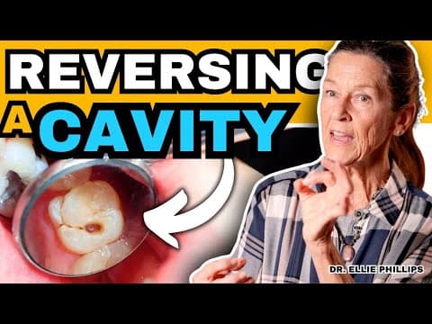 How To Reverse a Cavity at Home | Cure Tooth Decay thumbnail