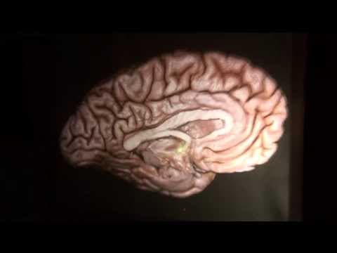 Brain Architecture Part 1 by Guilherme Carvalhal Ribas, M.D. thumbnail