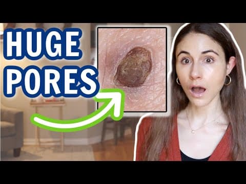 HUGE PORES ON THE FACE & HOW TO GET RID OF THEM // Dermatologist @DrDrayzday thumbnail