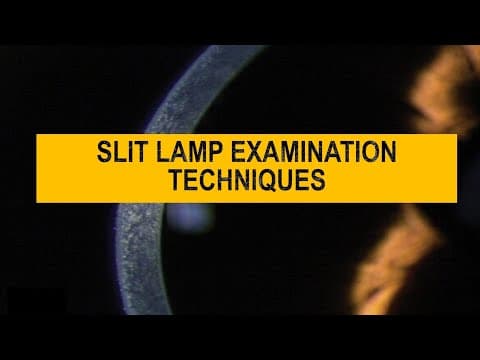 Diffuse v/s Focal | Optical section ,parallel pipe , conical illumination - SLIT LAMP techniques thumbnail