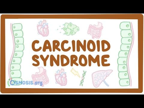 Carcinoid Syndrome - causes, symptoms, diagnosis, treatment, pathology thumbnail