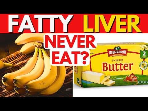 9 AWFUL foods for Fatty Liver (+10 great Liver-Friendly alternatives) thumbnail