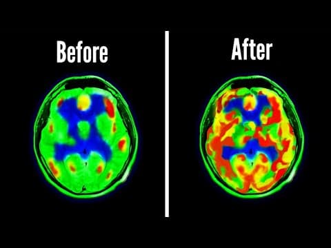 How Dopamine Detoxing Changed My Brain thumbnail
