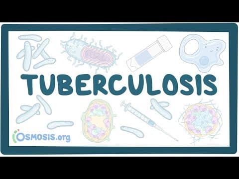 Tuberculosis - causes, symptoms, diagnosis, treatment, pathology thumbnail