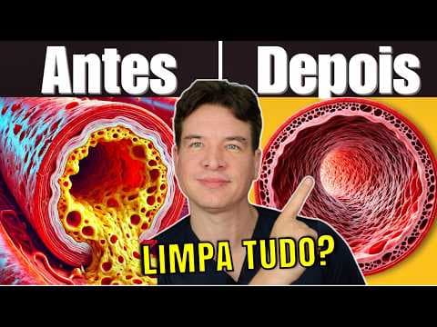 Discover the TEST that can save your heart – Are your arteries at RISK? (unclog your arteries) thumbnail