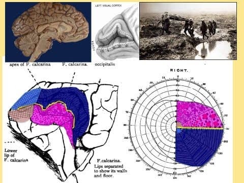 Why we see what we do - Professor Wiliam Ayliffe thumbnail