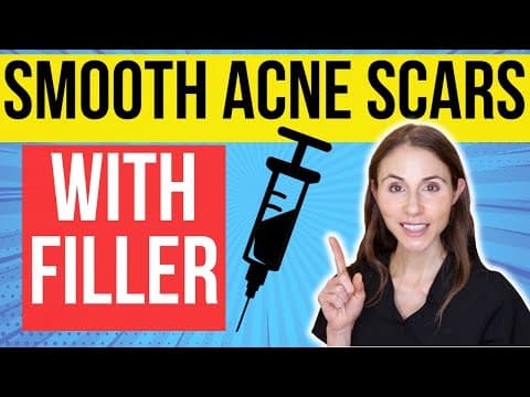 Filler For Acne Scars | Dermatologist Explains thumbnail