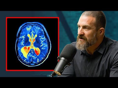 How Does Dopamine Influence Relationship Anticipation? thumbnail