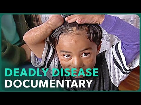 Meningitis: Search For A Cure (Medical Documentary) | Real Stories thumbnail