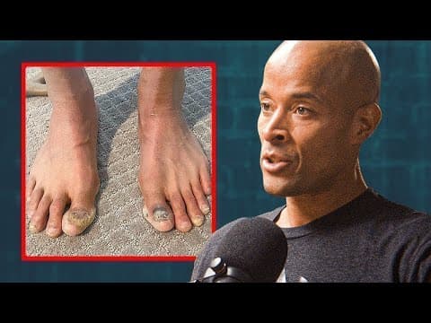 What Made David Goggins' First 100-Mile Race So Painful? thumbnail