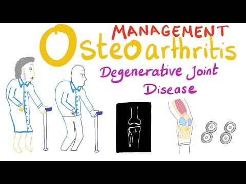 Osteoarthritis (OA) - Treatment -  Degenerative Joint Disease - Rheumatology Series thumbnail