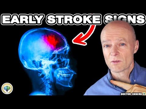 10 Warnings Signs Of STROKE A Week BEFORE It Happens thumbnail
