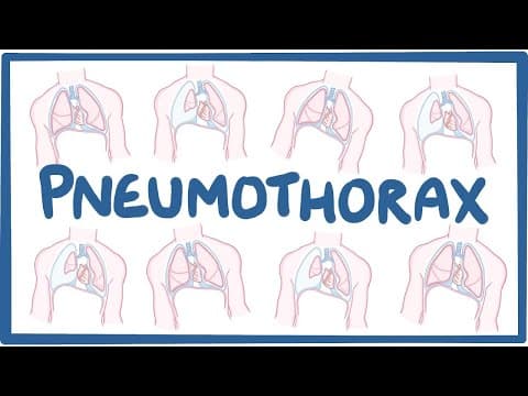 Pneumothorax - causes, symptoms, diagnosis, treatment, pathology thumbnail