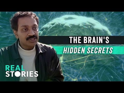 The Most Bizarre Neurological Conditions You Never Heard Of thumbnail
