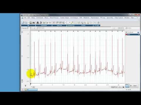 Using a Macro in LabChart to calculate RR intervals and Heart Rate Variability (HRV) thumbnail