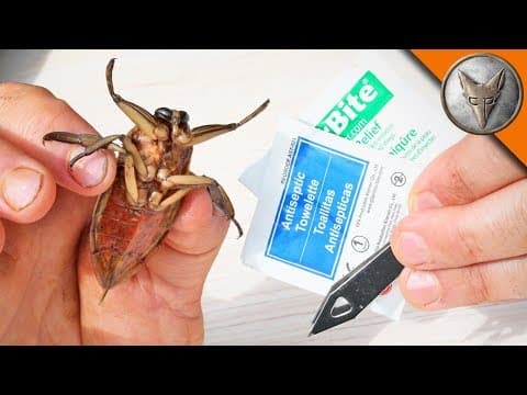 How to Treat a Toe Biter Bite Effectively thumbnail
