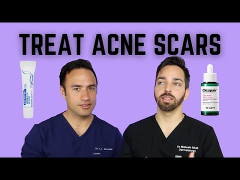 HOW TO TREAT ACNE SCARS | DOCTORLY thumbnail
