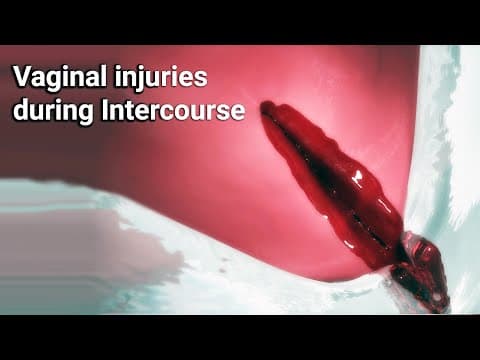 Vaginal injuries during intercourse thumbnail