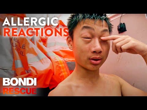 The Scariest Allergic Reactions on Bondi Rescue thumbnail