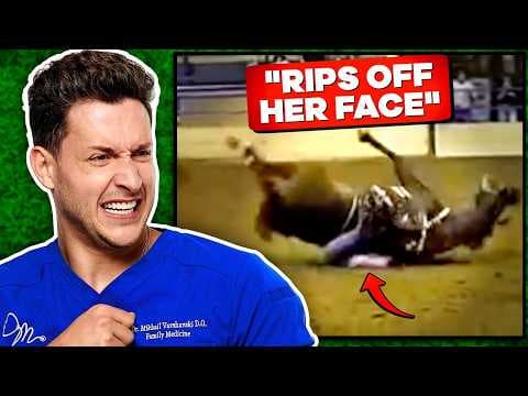 Doctor Reacts To Shocking Horse Riding Injuries thumbnail