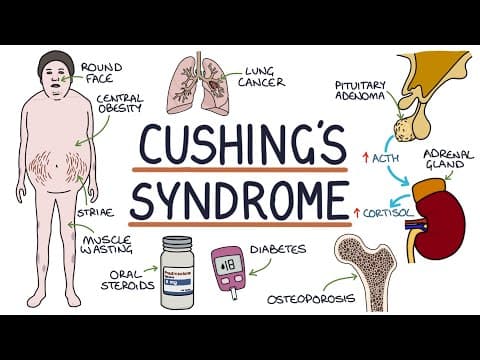 Understanding Cushing's Syndrome thumbnail