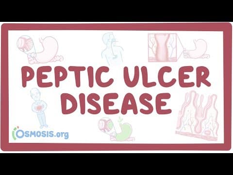 Peptic ulcer disease - causes, symptoms, diagnosis, treatment, pathology thumbnail