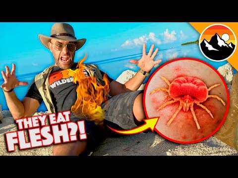What Happens When You Get Bitten by Chiggers? thumbnail