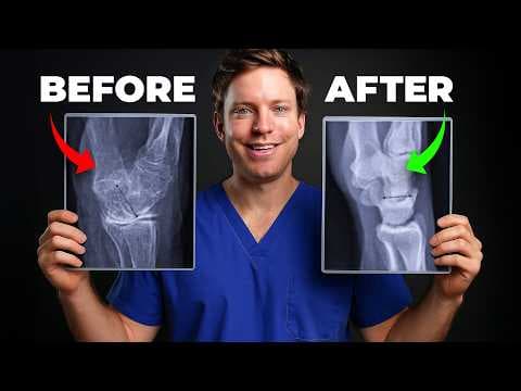 Do This Daily to STOP Bone Loss & Prevent Fractures thumbnail