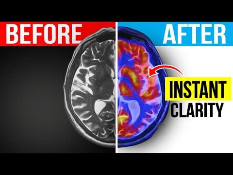 The Fastest & Simplest Way To Get Rid of Brain Fog thumbnail