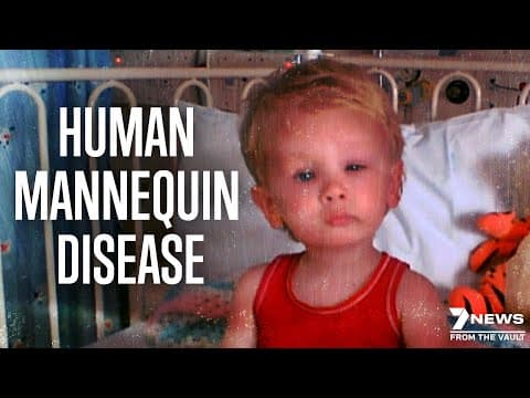 World's Rarest Disease: The Human Mannequin | Documentary thumbnail