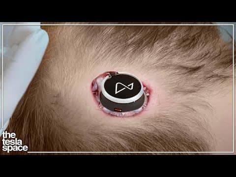 The 2023 Neuralink Update Is Here! thumbnail