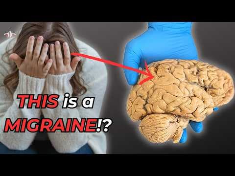 Why Migraines Are More Than Just a Headache thumbnail
