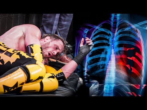 I Broke My Ribs At SummerSlam thumbnail